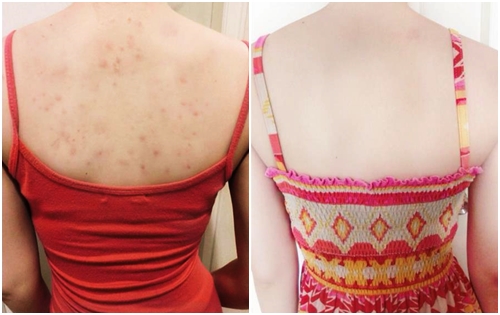 เคล็ดลับหลังขาวใส เคล็ดลับหลังขาวใส