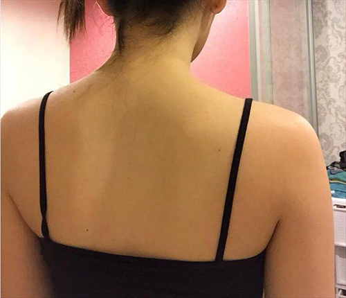 เคล็ดลับหลังขาวใส เคล็ดลับหลังขาวใส