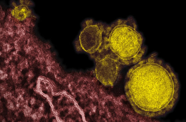 เกาหลีใต้ไวรัส MERS ระบาดหนัก จ่อห้ามผู้อาจติดเชื้อเดินทาง
