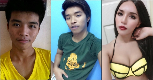 ศัลยกรรมเปลี่ยนชีวิต