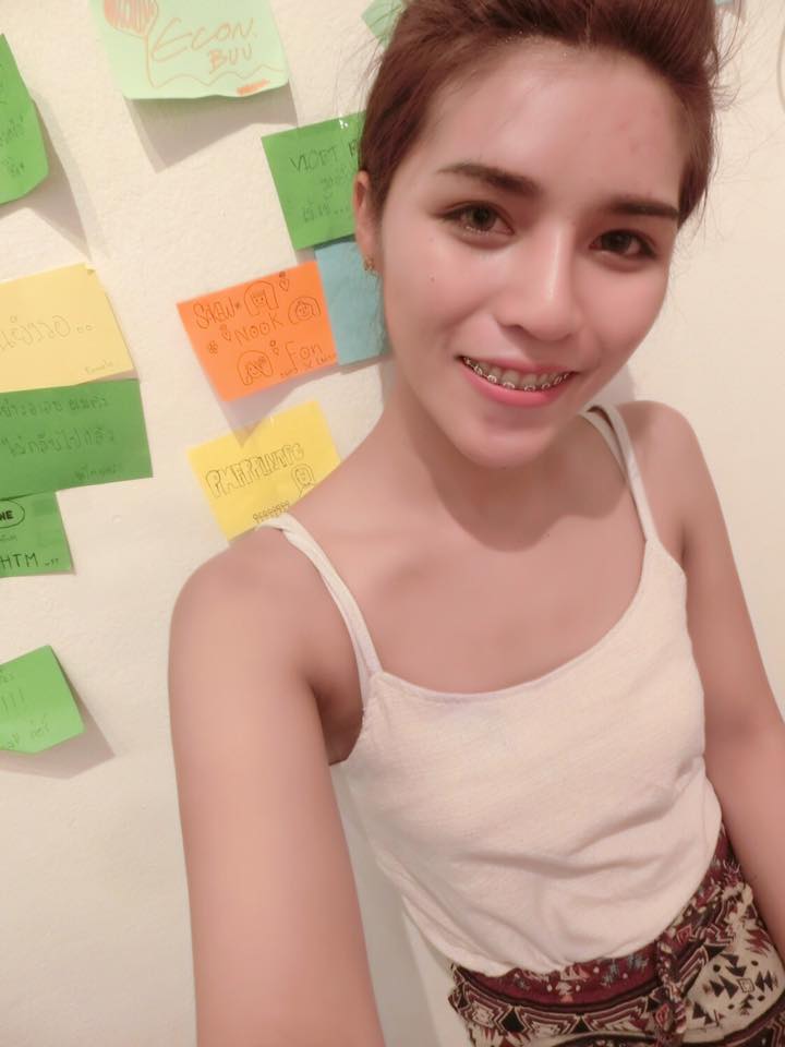 ศัลยกรรมเปลี่ยนชีวิต