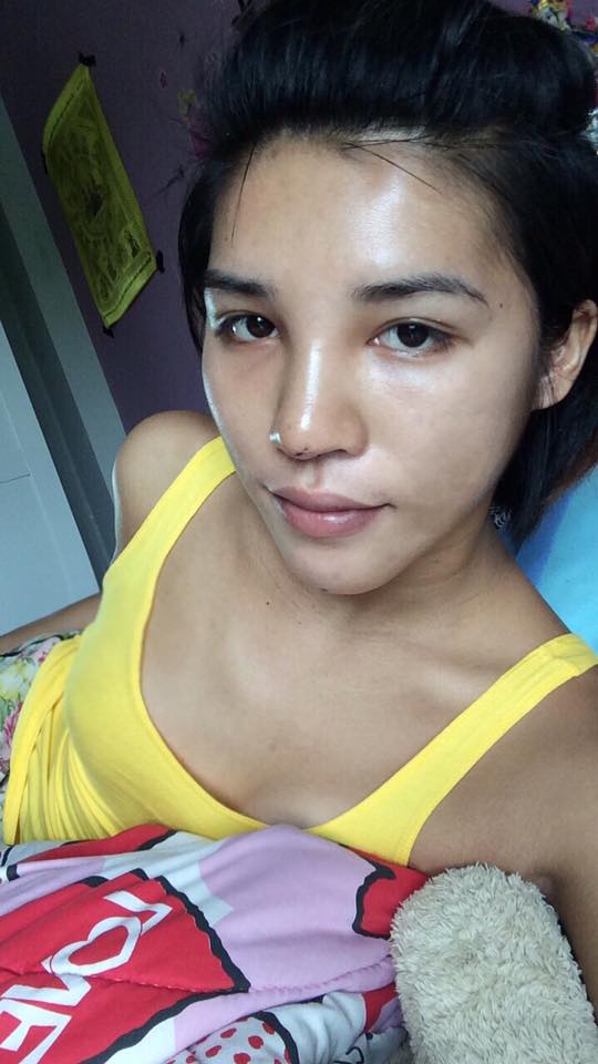 ศัลยกรรมเปลี่ยนชีวิต