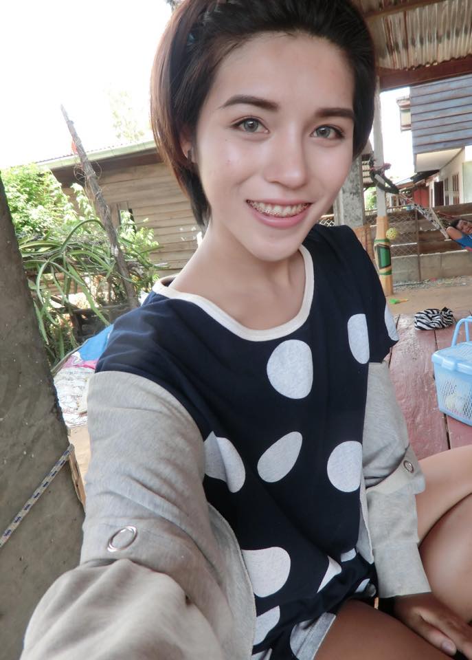 ศัลยกรรมเปลี่ยนชีวิต