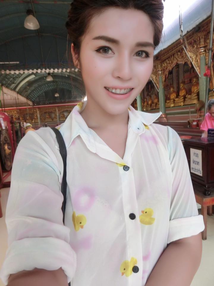 ศัลยกรรมเปลี่ยนชีวิต