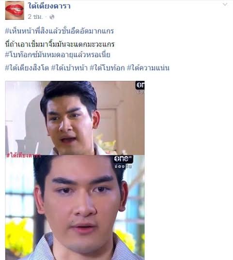 สิงโต เดอะสตาร์ ศัลยกรรม สิงโต เดอะสตาร์ ศัลยกรรม