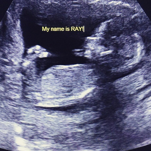 ทาทา ยัง พี่หมอ น้องเรย์