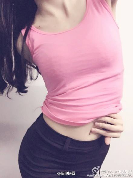 หมอเตือนเทรนด์ฮิต เซลฟี่จับสะดือ เสี่ยงกระดูกเคลื่อน