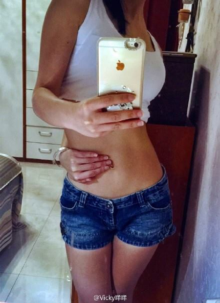 หมอเตือนเทรนด์ฮิต เซลฟี่จับสะดือ เสี่ยงกระดูกเคลื่อน