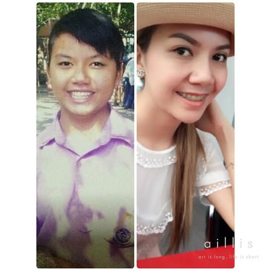 10 ดารานักร้องซุปตาร์ อดีต-ปัจจุบัน หน้าเปลี่ยนจนจำแทบไม่ได้