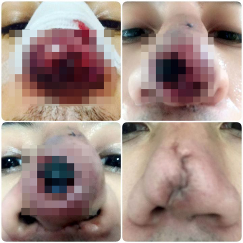 อุทาหรณ์เตือนใจ