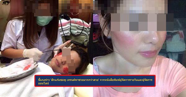 สักแก้มชมพู