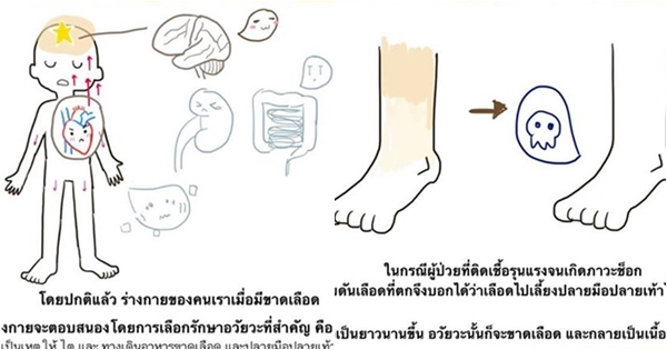 ความรู้ฉบับการ์ตูน อ่านแล้วจะเข้าใจ ทำไมต้องตัดขา ปอ ทฤษฎี