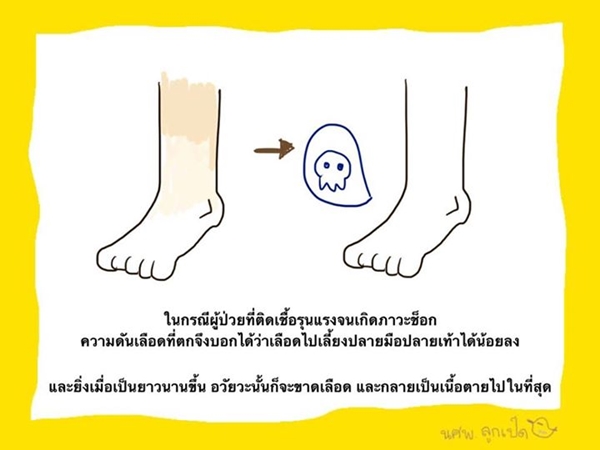 ความรู้ฉบับการ์ตูน อ่านแล้วจะเข้าใจ ทำไมต้องตัดขา ปอ ทฤษฎี