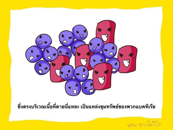 ความรู้ฉบับการ์ตูน อ่านแล้วจะเข้าใจ ทำไมต้องตัดขา ปอ ทฤษฎี