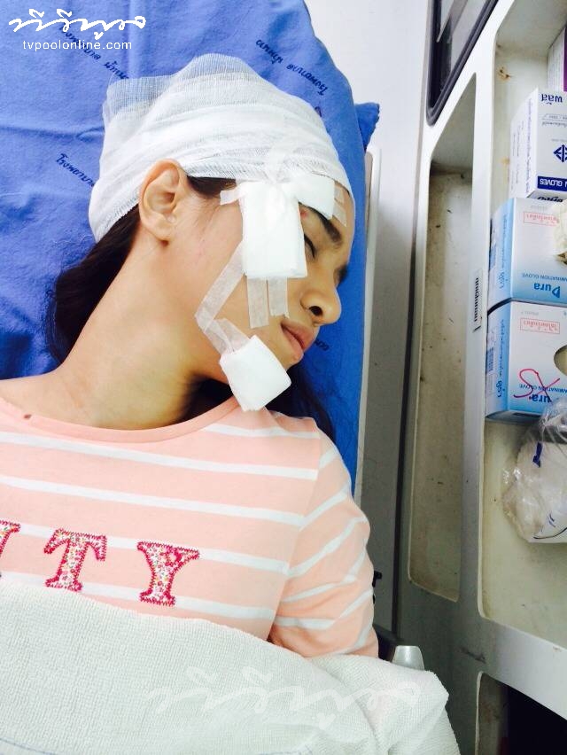 เกรซ เดอะสตาร์ 6