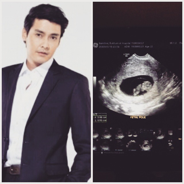 เขตต์ ฐานทัพ เฮลั่น ! ภรรยา แนท เปรมิการ์ ตั้งครรภ์แล้ว 