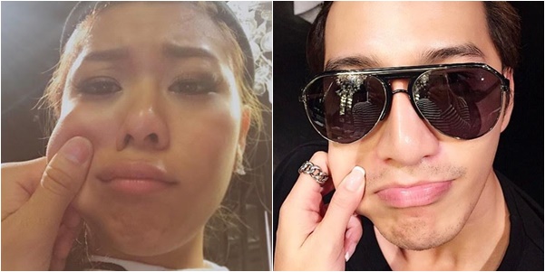 บี้ เคพีเอ็น กุ๊บกิ๊บ