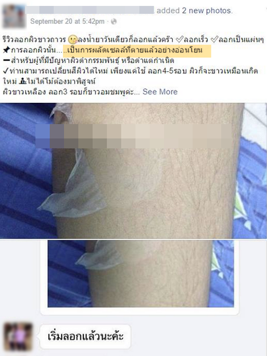 น้ำยาลอกผิวถาวร ลอกผิวออกมาเป็นแผ่น ๆ 