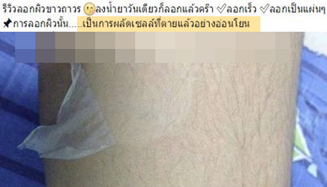 น้ำยาลอกผิวถาวร ลอกผิวออกมาเป็นแผ่น ๆ