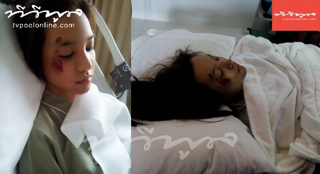 เกรซ เดอะสตาร์ 6