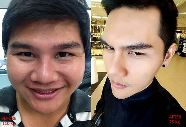 วิธีลดน้ำหนัก