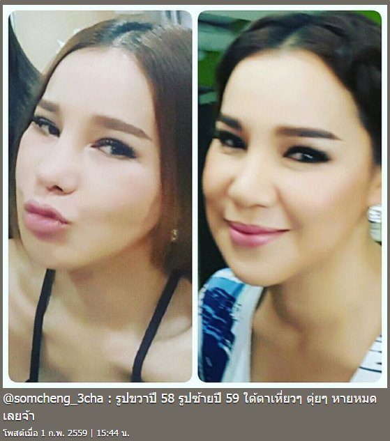 ส้มเช้ง สามช่า ศัลยกรรม