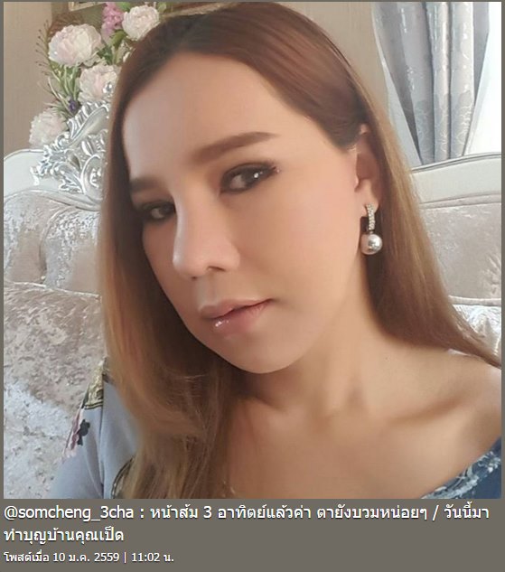 ส้มเช้ง สามช่า ศัลยกรรม