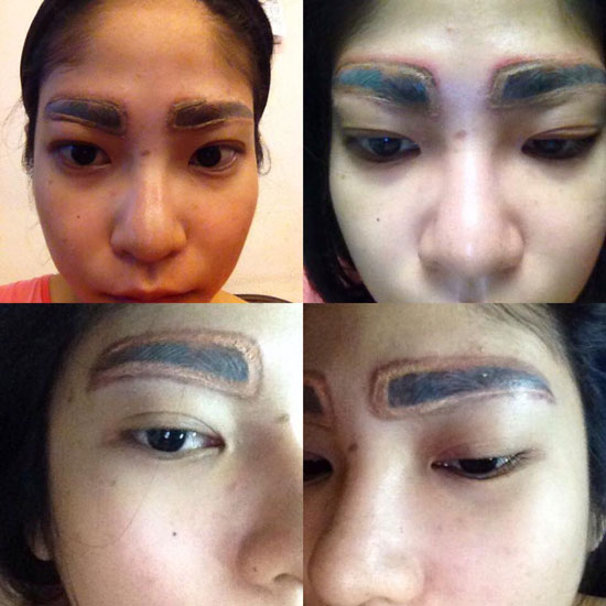 สักคิ้วพลาด