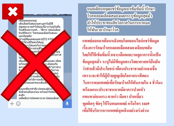ใช้เข็มทิ่มนิ้วรักษาผู้ป่วยโรคหลอดเลือดสมองเฉียบพลัน สุดมั่ว