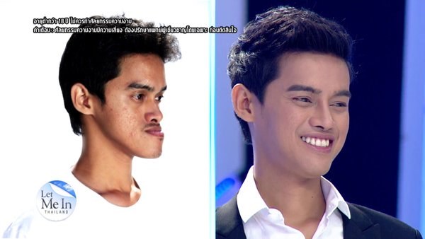 เจษ เจษฎา Let Me In Thailand ผู้ชายคนแรก