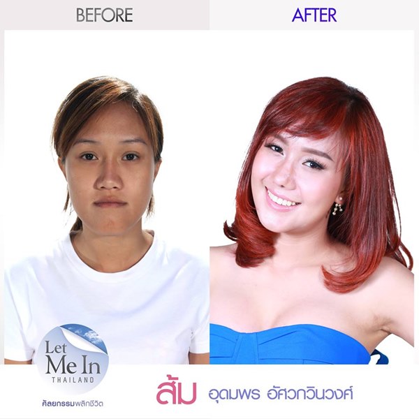 ส้ม อุดมพร Let Me In Thailand คนที่ 10