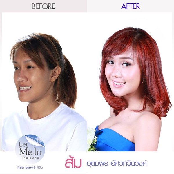 ส้ม อุดมพร Let Me In Thailand คนที่ 10