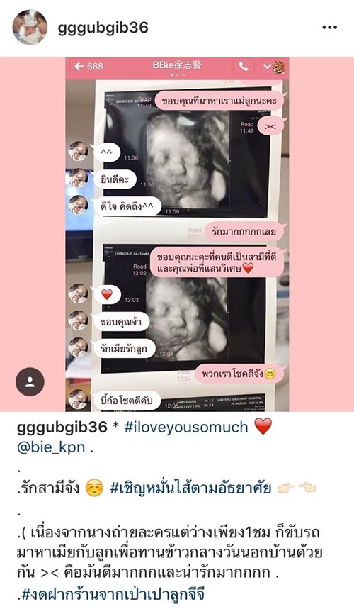 กุ๊บกิ๊บ สุมณทิพย์ ส่งไลน์หา บี้ KPN