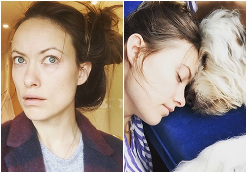 ดาราต่างประเทศ ทำจมูก