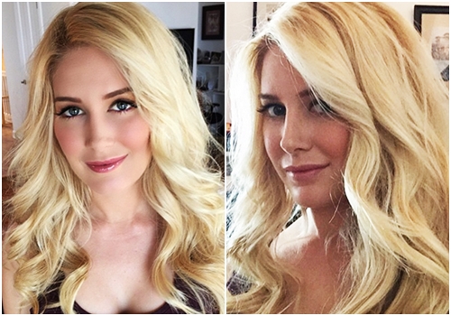 ดาราต่างประเทศ ทำจมูก