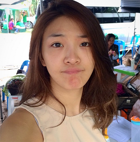 หญิงแย้ ก่อนศัลยกรรม