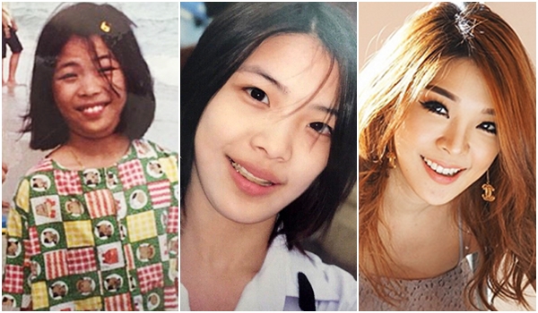 หญิงแย้ ก่อนศัลยกรรม