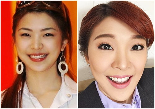 ดาราทำตาสองชั้น