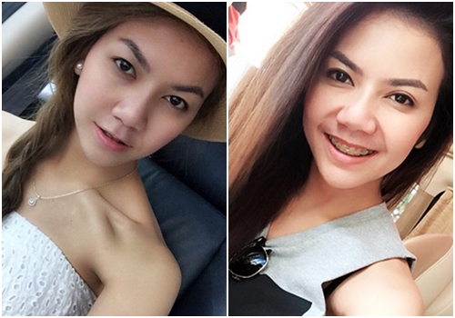 ดาราทำตาสองชั้น