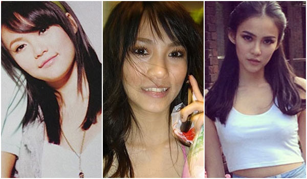 กิ๊บซี่ ก่อนศัลยกรรม