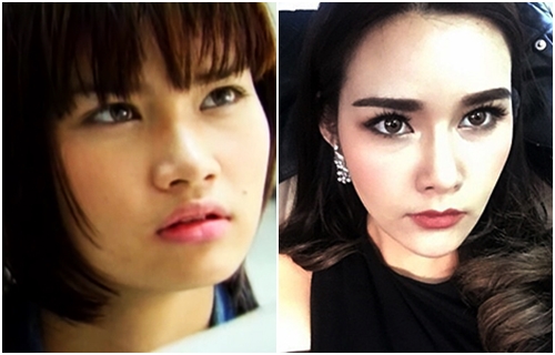 ดาราทำจมูก