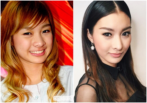 ดาราทำจมูก