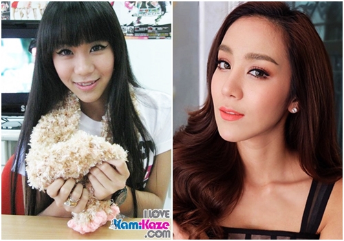 ดาราทำจมูก