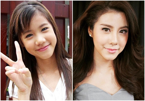 ดาราทำจมูก