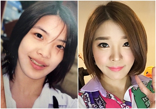 ดาราทำจมูก