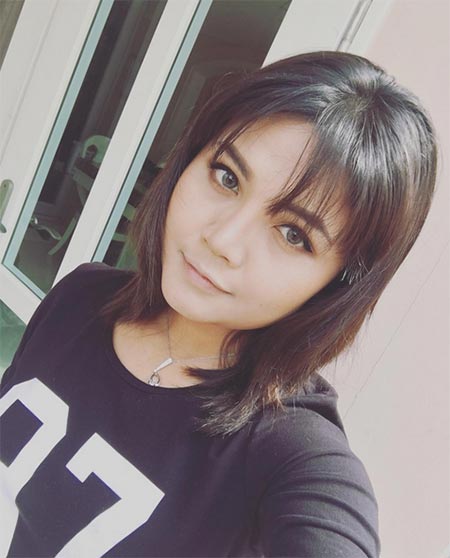 ตั๊กแตน ชลดา before after