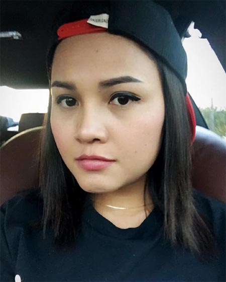 ตั๊กแตน ชลดา before after