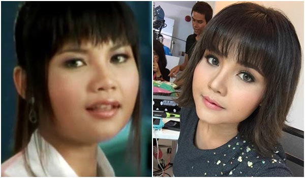 ตั๊กแตน ชลดา before after