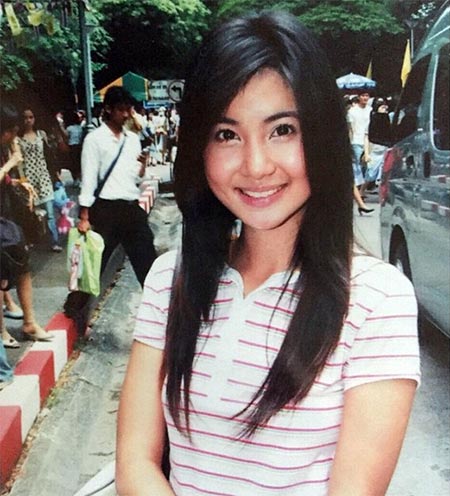 จ๊ะจ๋า พริมรตา ศัลยกรรม