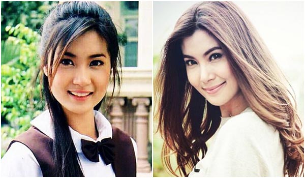 จ๊ะจ๋า พริมรตา ศัลยกรรม